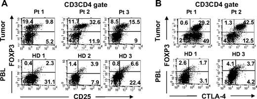 Figure 2. Phenotypic comparison of FOXP3+CD4 T cells in tumors versus peripheral blood in healthy donors. Tumor digests from patients and peripheral blood samples from healthy donors were thawed and immediately stained with anti-CD3, anti-CD8, and anti-FOXP3 mAb along with either (A) anti-CD25 or (B) anti–CTLA-4 mAbs. The dotplots were gated on CD3CD4 (CD3+CD8−) T cells. The numbers represent the percentages of CD4 T cells in each quadrant. These results are representative of several independent experiments using tumor digest samples (n = 26) and PBL samples from the same patients (n = 9) and healthy donors (n = 5).