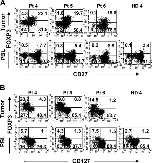 Figure 3. Comparison of surface expression of CD27 and CD127 on FOXP3+CD4 T cells in tumors versus peripheral blood from the same patients. Tumor digests and peripheral blood from patients were thawed and immediately stained with anti-CD3, anti-CD8, and anti-FOXP3 mAb along with either (A) anti-CD27 or (B) anti-CD127 mAbs. The dotplots were gated on CD3CD4 (CD3+CD8−) T cells. The numbers represent the percentages of CD4 T cells in each quadrant. These results are representative of multiple independent experiments using tumor digest (n = 19) and PBLs (n = 9) samples from the same patients with metastatic melanoma.