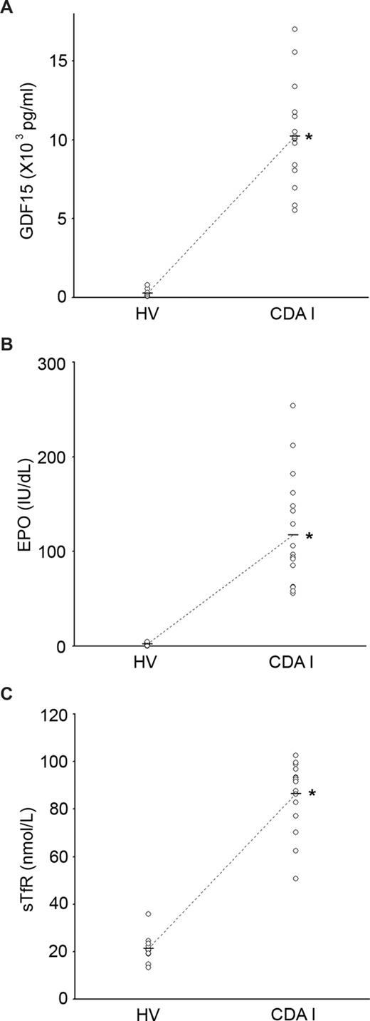 Figure 1. GDF15, EPO, and sTfR levels in healthy controls and congenital dyserythropoietic anemia (CDA) I patients. Serum concentrations of (A) GDF15, (B) EPO, and (C) sTfR from healthy volunteers (HV) and patients with CDA I. Mean values (bars) and levels for individual volunteers (○) are shown. *P < .05.