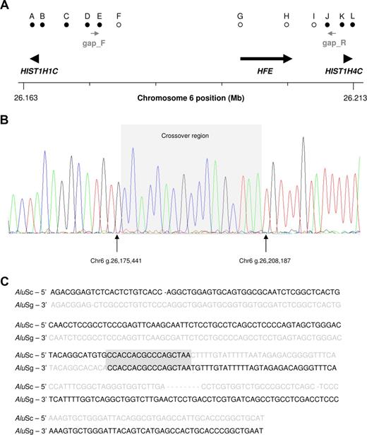 Figure 1. Detection and molecular characterization of a large deletion at the HFE locus. (A) Summary of mapping PCRs showing location of primer pairs on the chromosome band 6p21.3. indicate a region deleted in the reported case and indicate an unmodified sequence. Positions and directions of the gap PCR primers are shown in grey. Numbering is based on the UCSC human genome assembly. (B,C) Sequencing electrophoretogram of the recombined allele and sequence alignment of the Alu elements (AluSc in 5′, and AluSg in 3′) responsible for the chromosomal alteration. The gray box highlights a 17 bp track of perfect homology that marks the crossover region. The sequence deleted in the new allele is shown in gray. Interestingly, the intervening sequence contains 2 sequence motifs, CCACCA and CCAGC. Both motifs represent truncated versions of the Chi hotspots (consensus sequence: 5′-GCTGGTGG-3′ or its complement, 5′-CCACCAGC) of generalized recombination.12,13 In particular, CCACCA has been previously reported as a mutational “super-hotspot” common to micro-deletions, micro-insertions, and indels.14