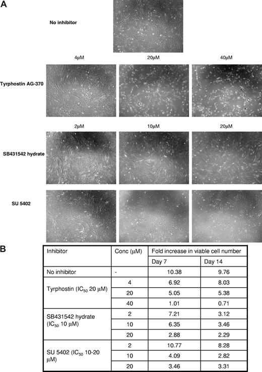 Figure 4. Activin-mediated TGF-β, PDGF, and FGF signaling are also important for MSC growth.Marrow-derived MSCs were cultured for 7 days in the presence of inhibitors of these pathways. Three doses (0.2× IC50 dose, IC50 dose, and 2× IC50 dose) were used for each inhibitor. Panel A shows the morphology of undifferentiated MSCs in the presence of these inhibitors. Panel B shows the fold increase in number of viable cells in these cultures. Fold increase in viable cells was calculated as ratio of viable cells in the culture on day 7 or day 14 compared with the starting number of viable cells that were seeded in these cultures. Micrographs were acquired by imaging with a Zeiss Axiovert 40 C microscope fitted with a 20×/0.3 NA objective and a Canon Powershot A620 camera. Image contrast was adjusted using the Auto Contrast function in Picasa.