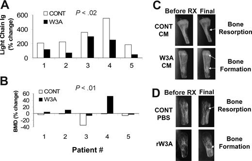 Figure 6. Wnt3A stimulates bone formation and attenuates primary MM growth in SCID-hu mice. SCID-hu mice engrafted with MM cells from 5 patients were daily injected with Cont-CM and Wnt3a-CM into the surrounding area of the implanted bones (patients 1 and 2) or treated with rWnt3a using Alzet pumps. (A,B) Changes in circulating human kappa Ig level (A) and in the BMD of the implanted bones (B) from pretreatment level. (C,D) X-ray radiographs showing changes in myelomatous bone mass of hosts treated with Cont-CM and Wnt3a-CM (C) and rWnt3a (D). Note that osteolytic lesions were evident before initiation of treatment (pre-Rx) and that, although in control hosts bone loss continued to increase (white arrows), Wnt3a treatment resulted in increased bone mass (white arrows).