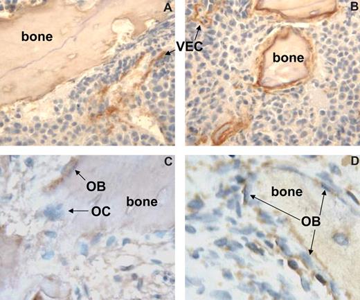Figure 7. Increased canonical Wnt signaling in osteogenic cells in myelomatous bones treated with Wnt3a. Myelomatous human bone sections were immunohistochemically stained with 8E7 antibody that reacts with the active form of β-catenin. (A,B) Bones were engrafted with H929/EV (A) and H929/W3A (B) MM cells. Note expression of active form of β-catenin in certain vascular endothelial cells (VECs) and in cellular components along the bone surface. Bones engrafted with H929/W3A had increased numbers of cells expressing the active form of β-catenin along the bone surface. (C,D) Primary myelomatous bones treated with Wnt3a had an increased number of osteoblastic (OB) cells expressing the active form of β-catenin. Osteoclasts (OCs) as well as MM cells expressed very low levels of β-catenin.