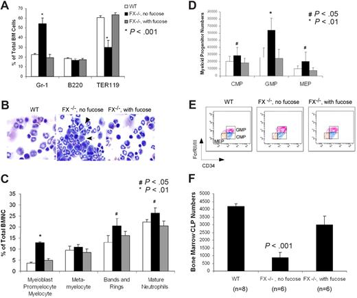 Figure 1. FX−/− mice develop a myeloproliferative disorder. (A) FACS analysis of the percentage of granulocytes (Gr-1+), B lymphocytes (B220+), and erythrocytes (TER119+) in the bone marrow in 3- to 4-month-old control mice (WT; n = 8), FX−/− mice reared on fucose-supplemented chow until 12 weeks of age, and then on standard chow for at least 4 weeks (n = 8; FX−/−, no fucose), and FX−/− mice reared on fucose-supplemented chow until use (n = 8; FX−/−, with fucose). (B) May-Grünwald-Giemsa–stained cytospins of marrow cells showing increased segmented neutrophils () and myeloid progenitor cells () in the bone marrow of FX−/− mice (no fucose). (C) Differential blood counts on May-Grünwald-Giemsa–stained cytospins of marrow cells showing percentage of myeloid progenitor cells at various developmental stage and mature neutrophils (WT, n = 8; FX−/−, no fucose, n = 9; FX−/−, with fucose, n = 9). (D,E) FACS analysis of bone marrow myeloid progenitors (CMP: Lin−c-kit+Sca-1−IL7R−CD34+FcγRIIlow; GMP: Lin−c-kit+Sca-1−IL7R−CD34+FcγRII+; MEP: Lin−c-kit+Sca-1−IL7R−CD34lowFcγRIIlow). (F) FACS analysis of CLP compartment (Lin−c-kitlowSca-1lowIL7R+). Bar graphs represent the average total number of CLP cells (± SD) from 2 tibias and 2 femurs of each mouse.