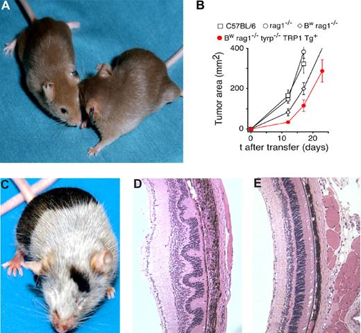 Figure 1. Characterization of the TRP-1 CD4+ model. (A) Characteristic cappuccino phenotype of white-based brown mutation (Bw) after 8 rounds of backcrossing onto a C57BL/6 background using “speed congenics.” The coat color appearance derives from a defect in exon 1 of tyrosinase-related protein-1 (tyrp1) gene. The MHC class II–restricted TCR used to create the TRP-1–specific transgenic mouse was isolated from Bw mice after multiple rounds of vaccination. (B) RAG1−/−Bw TRP-1 Tg+ animals are marginally protected against the B16 challenge. C57BL/6, RAG1−/−, RAG1−/−Bw, and their RAG1−/−BwTRP-1 TCR transgenic littermates were injected subcutaneously with 0.5 × 106 B16 melanoma cells. Results for tumor area are the mean of measurements from at least 5 mice per group (± SEM). Data shown are representative of 2 independent experiments. (C) Adoptive transfer of 0.25 × 106 naive purified TRP-1 CD4+ T cells into a tyrp1+/+ (wt, black) RAG1−/− mouse results in a rapid development of massive vitiligo. (D) H&E staining of ocular tissue from the mice that received adoptive transfer of naive TRP-1 cells revealed diffuse damage with edema, retinal folding, disruption of pigmented epithelium, and inflammatory infiltrate in the choroid. (E) An H&E stain of a normal eye at a similar magnification from an untreated RAG1−/− mouse is shown as a control.