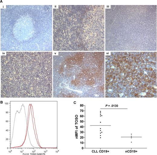 Figure 2. Protein analysis of TOSO using CLL tissue microarray and quantitative flow cytometry. (A) Immunohistochemistry for TOSO in tissue microarray cores. The entire 1-mm core was analyzed using a Leica DM2500 microscope, and images were acquired by a Leica DFC320 camera and processed using Leica IM50 software (Meyer Instruments, Houston, TX) at low (10×/0.30, HC PL FLUOTAR) and high (40×/0.75, HCX PL FLUOTAR) power objective magnification (OM) in each case, and the consensus of 2 cores was accepted. Results shown demonstrate (i) positive cells in mantle zone of tonsil OM ×10; (ii) positive cells in mantle zone of tonsil OM ×40; (iii) negative CLL sample OM ×10; (iv) negative CLL sample OM ×40; (v) positive CLL sample OM ×10; (vi) positive CLL sample OM ×40. A total of 44 CLL samples were assessed for TOSO. (B) Quantitative flow cytometry demonstrating a shift in TOSO expression in 2 CLL cases (red lines) against a single healthy individual (gray line). (C) Graphic comparison for normalized median fluorescence intensity (nMFI) for TOSO in CLL and nCD19+ cells (nMFI = 44.98 ± 18.31 in CLL vs 7.96 ± 11.45 in nCD19+ cells, P = .31, Mann-Whitney test). Bars represent the median values.