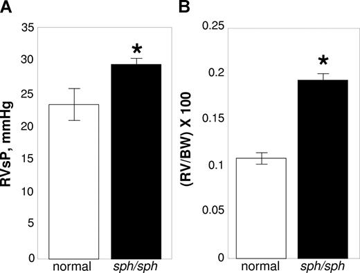 Figure 1. Evidence for pulmonary hypertension in sph/sph mice. (A) RVSP is increased in sph/sph mice compared with normal mice. (B) RV/BW in increased in sph/sph mice compared with normal mice. Anesthetized control (normal, □) and sph/sph (■) mice were placed in a supine position while breathing room air. RvSP (A) was measured as described under “Methods.” After measurement of RvSP, mice were euthanized, hearts were resected, and RV/BW (B) was determined as described under “Methods.” Data are presented as mean (± SEM) for n = 4 normal and n = 6 sph/sph mice. Normal mice were between 6 and 12 weeks of age; n = 3 sph/sph mice were 6 weeks of age, and n = 2 were 12 weeks of age and n = 1 was 22 weeks of age. No differences in RvSP or RV/BW were noted between the younger and older sph/sph mice used for these experiments. *P < .03 for RVSP (A) and P < .0001 for RV/BW (B) sph/sph compared with normal mice.