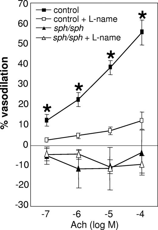 Figure 2. Impaired dilation of the facialis artery in sph/sph mice in response to stimulation with acetylcholine. Facialis arteries (180-250 μm) were isolated from control (■,□) and sph/sph (▴,▵) mice as described under “Methods.” Pressurized arteries were preconstricted with the thromboxane A2 agonist U46619 (10−9-10−8 mol/L; 15-hydroxy-11α,9α-(epoxymethano)prosta-5,13-dienoic acid). Vessel dilation in response to stimulation with acetylcholine (ACh; 10−7 to 10−4 mol/L) was recorded in the absence (■,▴) and presence (□,▵) of the NO antagonist l-NAME (100 μM). Data are presented as mean (± SEM) for n = 9 vessels from n = 7 control mice, and n = 8 vessels from n = 6 sph/sph mice. Normal mice were all older than 12 weeks of age; n = 3 sph/sph mice were 7 to 10 weeks of age, and n = 3 were 13 to 18 weeks of age. No differences in vessel dilation were observed in younger versus older sph/sph mice. *P < .005, control vessel dilation without l-NAME compared with sph/sph vessel dilation without l-NAME.