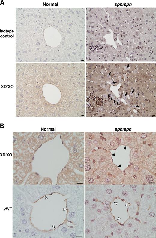 Figure 5. IHC reveals release of XO from liver and presence of XO on liver vascular endothelium of sph/sph mice. (A) DAB-based IHC of liver sections from normal (+/+) and sph/sph mice with an antibody that detects both XD(the form stored in liver hepatocytes) and XO (generated by cleavage of XD by plasma proteases). Pictures shown are representative of results obtained from 3 different mice of each genotype (+/+, sph/sph; all mice more than 12 weeks old). Diffuse staining is seen in hepatocytes from normal mice (botom left panel). Sections from sph/sph mice (bottom right panel) show the presence of hepatocytes with little or no staining for XD/XO (). Bar, 10 μm. (B) High magnification of liver sections from normal and sph/sph mice. Top panels, staining for XD/XO, with presence of XO staining on endothelium of blood vessel in sph/sph (▶) but not +/+ mice. Bottom panels: adjacent sections stained (▷) with an antibody to VWF, an endothelial-specific marker. Bar, 10 μm. Pictures shown are representative of results obtained from 3 different mice of each genotype as described for Figure 5A.