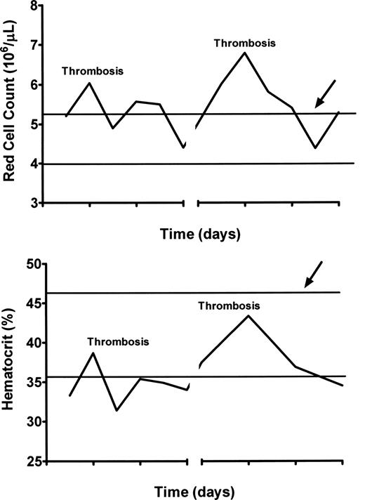 Figure 3. Comparison of simultaneous hematocrits and red cell counts in a woman with PV and hepatic vein thrombosis experiencing recurrent thromboses of stents and shunts during therapeutic anticoagulation. The red cell count is above normal at the time of each thrombosis, whereas the hematocrit is not. The heavy lines indicate the upper and lower limits of normal for each.