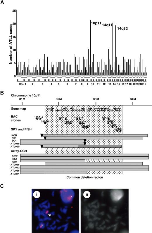 Figure 1. Mapping of the deletions at 10p11.2. (A) Mapping of the chromosomal breakpoints in whole chromosomes in acute-type ATLLs. An analysis of the chromosomal breakpoints was performed by spectral karyotyping (SKY), and all chromosomal breakpoints were mapped in each region of the chromosomes (x-axis), as indicated at the bottom. The y-axis shows the numbers of ATLL cases with the chromosomal breakpoints in each chromosomal region. Three regions, 10p11, 14q11, and 14q32, were frequently identified with chromosomal breakpoints. (B) Physical and transcriptional maps of the region containing the chromosomal deletion at 10p11. A FISH analysis was performed on metaphase and interphase chromosomes using 53 BAC clones mapped to the chromosome bands at 10p11-12 in the human genome map of NCBI (build 36 version 126) as probes. The bars indicate the region covering each BAC clone. Horizontal bars indicate the region with hemizygous deletions in each DNA sample from the ATLL cell lines or ATLL cells from patients, which were detected by SKY and FISH or array-CGH analyses. The inverted triangles indicate the regions of chromosomal breakpoints. Closed bars indicate the region of a homozygous deletion in a DNA sample from ATLL cells (ATL090). The hatch pattern represents the minimal heterozygous deletion at 10p11.2. TCF8 through NRP1 represent the names of the genes within the region in the human genome map of NCBI (build 36 version 126). (C) FISH validation of the RP11-188L14 probe to detect the hemizygous deletion of the chromosome10p11.2 in SO4 cell line. The RP11-188L14 probe was green (FITC) and the whole chromosome painting probe was red (TRITC). FISH with RP11-188L14 shows no signal on the abnormal chromosome 10 as indicated by the arrow (i), and a DAPI photograph corresponding to the FISH picture is shown on the right side (ii). Images were captured through the oil objective lens (100×) with a CCD camera (SenSys 0400-GI; Photometrics Ltd, Tucson, AZ). Subsequent image processing was performed with the Software IPLab version 2.4.0 (BD Biosciences Bioimaging, Rockville, MD).