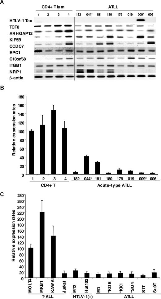 Figure 2. Down-regulated expression of TCF8 in ATLL cells. (A) The expression profiles of the genes mapped within the deletion region at 10p11. Semiquantitative reverse-transcription PCR (RT-PCR) was performed to determine the expression of the genes mapped within the deletion region. TCF8, ARHGAP12, KIF5B, CCDC7, EPC1, C10orf68, ITGB1, and NRP1 showed a single band of amplified cDNA from CD4+ T lymphocytes from healthy volunteers as controls and from ATLL cells from the patients. A band of HTLV1 Tax was amplified from only 1 of 8 ATLL cells. A vertical line has been inserted to indicate a repositioned gel lane. (B) Quantitative RT-PCR analysis of TCF8 mRNA in 4 samples of CD4+ T lymphocytes from healthy volunteers and 8 samples of ATLL cells from the patients. The data were normalized to β-actin mRNA and calibrated to the TCF8/β-actin ratio (ΔCT) in the case of healthy volunteer no. 1, as a relative expression rate of 100. The data are the mean and standard deviation of 2−ΔΔCt in a duplicate assay. Two patients (indicated by *) have the chromosome 10p11.2 abnormalities. (C) Quantitative RT-PCR analysis of TCF8 mRNA in various types of T lymphoblastic leukemia cell lines. MOLT4, MKB1, KAWAI, and Jurkat are T-lymphoid leukemia cell lines; MT2 and HUT102 are HTLV-1–infected cell lines; and ED, KOB, KK1, SO4, S1T, and Su9T are ATLL cell lines. Three ATLL cell lines (indicated by *) showed the deletion of chromosome 10p11.2 with TCF8.