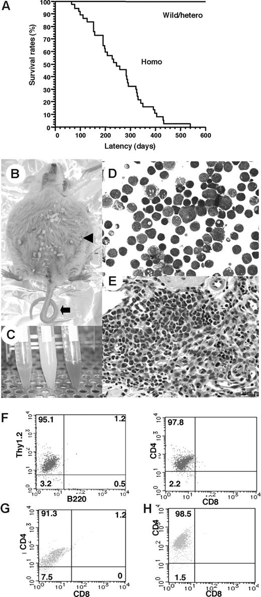 Figure 4. Survival rates and pathologic findings in TCF8 mutant mice. (A) The survival rates of a cohort of wild-type (wild), TCF8 heterozygous (hetero), and TCF8 homozygous (homo) mutant mice were followed over the indicated period using Kaplan-Meier plots. (B) Gross photograph of TCF8 mutant mice with ascites (◀). Approximately 30% of TCF8-homologous mutant mice showed curled tail (). (C) Bloody or milky ascites was pooled. (D) May-Giemsa staining of tumor cells in ascites. Original magnification ×400. (E) Many lymphoma cells with medium- to large-sized nuclei infiltrated in the mesentery. Cells were examined using an Axioskop 2 plus inverted microscope (Carl Zeiss, Rugby, United Kingdom) and digital images were aquired using AxioCam camera and AxioVision 2.05 software (Carl Zeiss). Original magnification ×400. (F) Tumor cells from ascitic fluids were analyzed by staining with a combination of monoclonal antibodies, either Thy1.2-PE with B220-FITC (left) or CD4-PE with CD8-FITC (right) and FACS. (G,H) The tumor cells that invaded liver (G) or spleen (H) were analyzed by staining with a combination of monoclonal antibodies, CD4-PE with CD8-FITC.