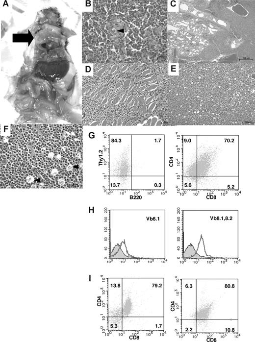 Figure 5. Pathological findings of TCF8 mutant mice. (A) Gross autopsy of TCF8 mutant mice with thymic tumors. A large thymic tumor () was observed at the mediastinum of the dissected mouse. (B) Hematoxylin and eosin staining of tumor sections from the mouse as indicated. The normal thymic cellular architecture in the TCF8 mutant mice is replaced with monotonous fields of large, highly mitotic lymphoblasts with small Hassall bodies (◀). The scale bar indicates 20 μm. Original magnification ×400. (C) The tumor cells invaded the lung, vascular tissues, and heart in the mouse. The scale bar indicates 500 μm. Original magnification ×25. (D) The tumor cells invaded the muscular tissues of the chest wall. The scale bar indicates 50 μm. Original magnification ×200. (E) Hematoxylin and eosin staining of peripheral lymph nodes. Tumor cells showed a diffuse proliferation of monomorphic lymphoma cells, focally mixed with tingible body macrophages (“starry-sky appearance”) (◀). The scale bar indicates 100 μm. Original magnification ×100. (F) Hematoxylin and eosin staining of peripheral lymph nodes. The scale bar indicates 20 μm. Original magnification ×400. (G) Tumor cells from the thymic tumor were analyzed by staining with a combination of monoclonal antibodies, either Thy1.2-PE with B220-FITC (left) or CD4-PE with CD8-FITC (right) and FACS. (H) The tumor cells of the CD3+B220− population did not express Vβ6.1 TCR (left), but showed weak expression of Vβ8.1-8.2 TCR (right). (I) Tumor cells from the liver (left) or spleen (right) were analyzed by staining with a combination of monoclonal antibodies, CD4-PE and CD8-FITC.