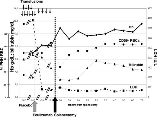 Figure 1. Laboratory parameters in relation to anticomplement treatment and splenectomy. ↓: Two units of packed red cells transfused. Eculizumab (Soliris, Alexion Pharmaceuticals) was started in September 2005 (gray arrow), according to the standard schedule (600 mg weekly ×4, then 900 mg fortnightly). Splenectomy was performed in May 2006 (black arrow), supported by vaccinations and antibiotics. No infections or other clinical complications have been recorded to date. The need for transfusion (17 units in the previous 12 months) remained stable during the TRIUMPH study (placebo arm), and was significantly reduced after introduction of eculizumab, which resolved intravascular hemolysis with LDH normalization; however, transfusion independence with hemoglobin stabilization was achieved only after splenectomy. Bilirubinemia was persistently elevated (almost entirely unconjugated) with some fluctuations, in part due to associated Gilbert syndrome (genetically confirmed by the presence of homozygous (TA)7 polymorphism of the UGT1A1 gene).