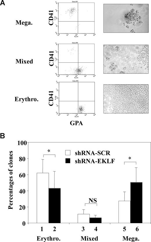 Figure 6. EKLF knockdown in normal human progenitors enhances megakaryocytic differentiation at the expense of erythrocytic differentiation. Human cord blood CD34+ cells were amplified for 3 days in E/MK medium, infected for 3 hours with either Eklf shRNA or control SCR shRNA lentiviruses. Immediately after infection, CD36+CD31Med cells enriched in bipotent progenitors were sorted by FACS and reseeded for 7 days in E/MK as described in “Lentivirus production and cell infection” and Figure S1. Each well was inspected under fluorescent microscope to identify clones containing GFP+ cells attesting successful infection and classified as megakaryocytic, erythrocytic, or mixed clones based on light-microscope observation, FACS analysis of the expression of GPA and CD41, and benzidine staining. Erythrocytic clones were identified by a large number of small cells expressing GPA but not CD41 and containing benzidine-positive cells; megakaryocytic clones were identified by a small number of large cells expressing CD41 but not GPA and containing no benzidine-positive cells; mixed clones were identified by an intermediate number of both types of cells. (A) Typical FACS diagrams and light-microscope fields illustrating erythrocytic, megakaryocytic, and mixed clones obtained. (B) Histogram shows the percentages of these 3 different types of GFP+ clones derived from cells infected with either Eklf shRNA (■) or control shRNA virus (□) (means and SD from 3 independent experiments with 60-92 GFP+ clones recorded for each condition). Statistically significant differences (P < .05; paired Student test) are indicated by asterisks (NS indicates nonsignificant).