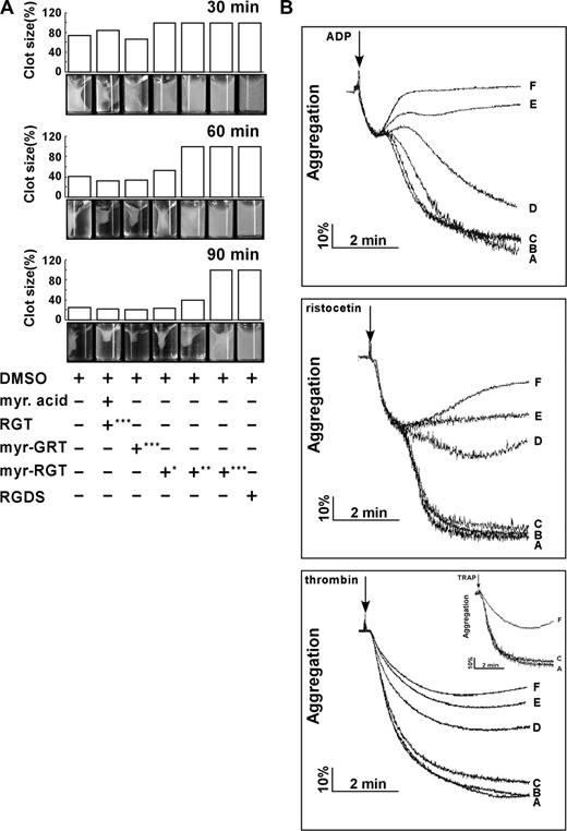 Figure 3. Effect of myr-RGT on fibrin clot retraction and platelet aggregation. (A) Washed platelets were resuspended in HEPES buffer and incubated with different peptides or their vehicles as indicated. Then 2 mg/mL of human fibrinogen was added and fibrin clot formation was initiated by adding 1 U/mL of thrombin. Clot retraction was monitored over time, and photographs of the clots were taken at different time points (bottom panel). Peptide concentrations: *62.5 μM; **125 μM; ***250 μM. The histograms of the clot size were generated from the photographs by calculating the ratio of the surface area of the retracted clot versus that of the initial clot. (B) Aggregation of nontreated or peptide-treated platelets was induced in an aggregometer at 37°C under constant stirring (1000 rpm) by ADP (2 μM), ristocetin (1.25 mg/mL) in PRP, or by thrombin (0.1 U/mL) in washed platelets preincubated with (A) DMSO, (B) myristic acid and RGT peptide at a concentration of 250 μM, (C) scrambled myr-GRT at 250 μM, myr-RGT at concentrations of (D) 62.5 μM, (E) 125 μM, and (F) 250 μM, respectively. (Inset) Platelets in plasma treated with 250 μM of (F) myr-RGT, (C) scrambled myr-GRT, or (A) vehicle DMSO were stimulated by TRAP (10 μM) to aggregate.