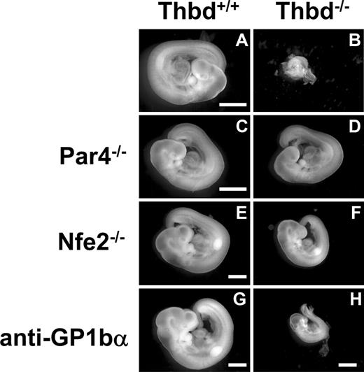 Figure 2. Phenotype of Thbd−/− embryos in Thbd+/− mothers. Thbd-expressing embryos (A,C,E,G) are shown with their respective Thbd−/− littermates (B,D,F,H). Embryos in panels A through D and E through H were photographed at E9.5 and E10.5, respectively. Thbd−/− embryos are resorbed by E9.5 (B). In mothers lacking the thrombin receptor Par4 (C,D), and in mothers lacking platelets due to Nfe2 deficiency (E,F) or anti-GP1bα antibody–induced depletion (G,H), Thbd−/− embryos completed axonal rotation (“turning”), a hallmark of transition from E8.5 to E9.5 stage of development. Embryos were photographed in water using equipment described in “Histology.” Scale bars represent 1 mm.