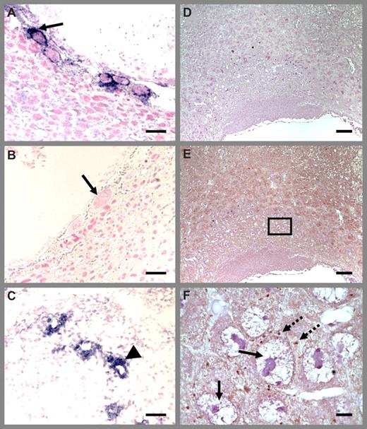Figure 3. Platelet localization in Thbd−/− placenta using P-selectin antibodies. Thbd-expressing (A) and -null (B) placentas were identified by in situ hybridization using antisense RNA probes. Blue color indicates Thbd expression. The null units express maternally derived Thbd in spiral arteries (C). Diffuse P-selectin stain (brown color) was observed at low magnification (E) (nonimmune IgG control in panel D), identified to correspond to platelets at higher magnification (F). Platelets are abundantly present in maternal blood spaces surrounding trophoblast giant cells. Platelet distribution was similar in Thbd−/− (E,F) and Thbd-expressing (not shown) utero-placental units. Slides were counterstained with nuclear fast red (A-C) or hematoxylin (D-F), mounted in Permount (Fisher Scientific, Pittsburgh, PA) and examined under a Nikon Eclipse E600 microscope (Nikon, Melville, NY). Pictures were taken using a 10×/0.3 (A-E) or 100× oil/1.3 (F) objective with a spot camera (Diagnostic Instruments, Sterling Heights, MI). Solid arrows indicate trophoblast cells; dashed arrows indicate platelets; arrowheads indicate spiral arteries. Panel F corresponds to the boxed region in panel E. Scale bars represent 0.05 mm (A-C), 0.1 mm (D), and 0.01 mm (E,F).