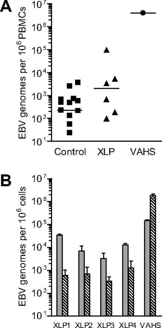 Figure 1. Analysis of EBV genome load in healthy control donors and patients with EBV-associated disease. (A) Results of quantitative PCR analysis to determine the EBV load in PBMC samples isolated from control donors, from XLP patients or from an EBV-AHS (VAHS) patient. Data are reported as EBV genome copies per 106 PBMCs, with the median value for each group denoted by the horizontal bar. (B) Results of quantitative PCR analysis to determine the EBV load in CD19+ B-cell () and CD19− non–B-cell () fractions isolated from XLP and VAHS PBMC samples. Data (mean and SD of 3 replicates) are reported as EBV genome copies per 106 cells.