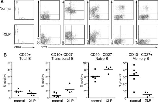 Figure 2. Surface phenotype of B cells from healthy control donors and XLP patients. (A) PBMCs from a healthy control donor and a representative XLP patient, XLP5, were stained with anti-CD20 mAb, and the frequency of B cells in the lymphocyte population determined (leftmost panels; frequency shown as percentage). In the remaining panels, purified CD20+ B cells were dual-stained with mAbs specific for CD27 and either CD10, IgD, IgM, IgG, or IgA to obtain the FACS profiles shown. (B) Summary of B-cell surface phenotype data obtained from 6 healthy control donors and 4 XLP patients (XLP5-8). Results are expressed (left to right) as the percentage of PBMCs that were CD20+ B cells, and the percentage of CD20+ B cells that had the transitional, naïve, or memory cell phenotypes shown. The mean value for each group is denoted by the horizontal bar.