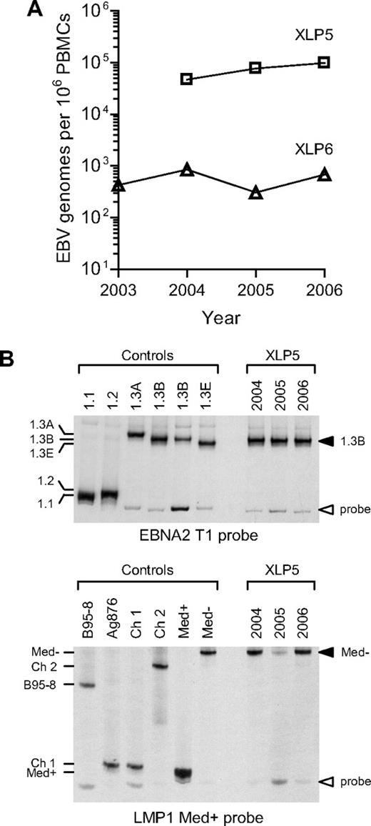 Figure 5. Analysis of EBV genome load and EBV sequences present in XLP patients. (A) The graph shows the results of quantitative PCR analysis to determine the EBV load in PBMC samples collected prospectively from patients XLP5 and XLP6 between 2003 and 2006. (B) Analysis of EBV sequences present in the same PBMC samples from patient XLP5 using EBNA2 and LMP1 HTAs. In the top panel, PBMC DNA was PCR-amplified using type 1 specific EBNA2 primers and the resulting PCR products analyzed by HTA using a 1.1 EBNA2 allele-specific probe. Also shown are the results from a panel of reference control isolates known to carry a 1.1, 1.2, 1.3A,1.3B or 1.3E EBNA2 allele. In the bottom panel, the same DNA samples were PCR-amplified using LMP1-specific primers and the resulting PCR products analyzed by HTA using a Med+ LMP1 allele-specific probe. Also shown are the results from a panel of reference control isolates known to carry a B95-8, Ag876/Ch1, Ch2, Med+ or Med− LMP1 allele. The results show that each XLP5 PBMC sample contains detectable 1.3B EBNA2 and Med− LMP1 alleles.