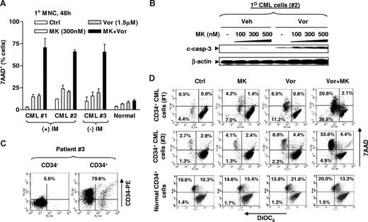 Figure 2. Vorinostat potentiates the lethality of MK-0457 in primary CML cells, while largely sparing normal bone marrow MNCs. (A) MNCs were isolated from bone marrow samples obtained from 2 patients with CML in chronic phase (patients 1 and 2) who had progressed after IM treatment, and from an additional patient (patient 3) who had not yet been treated, as well as from a normal bone marrow specimen. MNCs were exposed to 300 nM MK with or without 1.5 μM Vor for 48 hours, after which the percentage of 7AAD+ cells was determined by flow cytometry. (B) MNCs from patient 2 were treated with 100 to 500 nM MK with or without 1.5 μM Vor for 48 hours, after which cells were lysed and subjected to Western blot analysis to monitor caspase-3 cleavage. (C,D) Primary CD34+ CML cells isolated from bone marrow MNCs were obtained from patients 1 and 3. Cells were then stained with PE-conjugated CD34 antibody and subjected to flow cytometry to determine the purity of CD34+ cells. A representative result is shown (C). Numbers reflect the percentage of cells in the 2 top quadrants. Isolated primary CD34+ CML cells as well as normal CD34+ cells were exposed to 300 nM MK with or without 1.5 μM Vor for 24 to 48 hours, after which cells were stained with both DiOC6 and 7AAD and subjected to flow cytometry. “Low” DiOC6 uptake/7AAD− (bottom left quadrant) corresponds to early apoptosis (mitochondrial damage, reflected by loss of Δψm) and “low” DiOC6/7AAD+ (top left quadrant) corresponds to late apoptosis. Values reflect the percentage of cells in the corresponding quadrants. Results represent the means plus or minus SD for experiments performed in triplicate (A). (B) Each lane was loaded with 100 μg protein. The results of a representative experiment are shown; an additional experiment yielded equivalent results. Veh indicates vehicle.