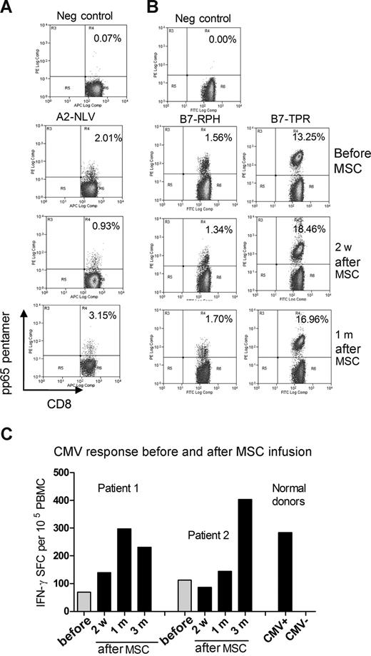 Figure 7. Anti-CMV T-cell immunity is preserved in vivo after MSC infusion. PBMCs from patient 1 (A) and patient 2 (B) were analyzed with pentamers for CMV-specific CD8+ T cells recognizing epitopes of pp65 before and after MSC infusion. (C) Frequency of IFN-γ producing PBMCs from 2 patients in response to pp65 peptides before and 2 weeks, 1 month, and 3 months after MSC infusion were analyzed with Elispot. IFN-γ response to pp65 in PBMCs from 3 healthy CMV-positive donors and 3 healthy CMV-negative donors were used as controls.