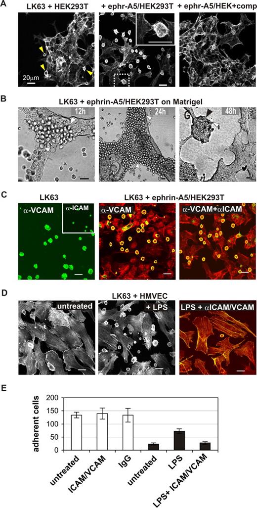 Figure 4. EphA3-mediated LK63 cell adhesion is independent of VCAM and ICAM functions. (A) LK63 cells were cocultured with parental HEK293T cells or ephrin-A5–expressing HEK293T clones (ephr-A5/HEK293T) as indicated; the inset is a magnification of the boxed section in the middle panel. Soluble monomeric ephrin-A5 was added to one of the cultures at 100-fold molar excess as competitive inhibitor of cell-surface ephrin-A5. (B) LK63 cells were cocultured on a layer of ephrin-A5/HEK293T cells in Matrigel. After 12, 24, and 48 hours, cells were imaged by bright-field microscopy. Individual LK63 cells (white arrowheads) remain bound to the ephrin-expressing cells to form large coherent colonies (black arrowhead) after 48 hours of culture. (C) Adhesion of LK63 cells to ephrin-A5/HEK293T cells was monitored in the presence of α-VCAM and α-ICAM antibodies. VCAM and ICAM expression on adherent LK63 cells was assessed by staining with α-VCAM and α-ICAM (inset) antibodies and Alexa488-conjugated secondary antibodies (left). Following 60-minute coculture in the presence of α-VCAM antibodies alone (middle), or together with α-ICAM antibodies (right), the cytoskeleton of fixed cells was stained with rhodamine-phalloidin. α-VCAM and α-ICAM were detected with Alexa488 secondary antibodies; the merged images are shown. (D) LK63 cells were cocultured on a monolayer of untreated (left) or LPS-treated (middle) HMVECS. To affect LPS-induced cell adhesion, HMVECS were incubated with function-blocking α-VCAM and α-ICAM antibodies (right) as indicated. Merged microscopic images (Alexa488, green; rhodamine-phalloidin, red) are shown. Scale bars represent 20 μm. (E) Cell-cell adhesion was quantified by counting LK63 cells remaining attached to untreated, α-ICAM-1/α-VCAM–treated or control IgG-treated ephrin-A5/293 cells (□), or untreated, LPS or LPS and α-ICAM-1/α-VCAM treated HMVECs (■) in a minimum of 4 representative microscopic sections at 10× magnification. Mean cell number and SE are shown.
