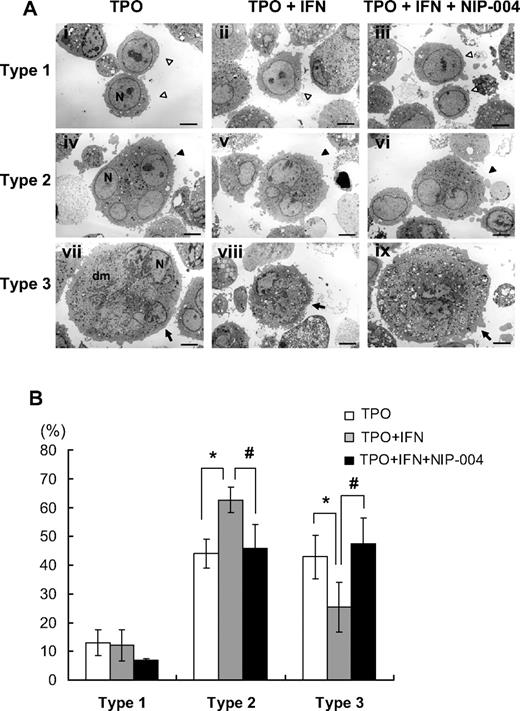 Figure 5. Ultrastructure of megakaryocytes cultured with or without IFN-α2b. (A) Ultrastructures of representative human megakaryocytes cultured with 10 ng/mL TPO, 10 ng/mL TPO plus 10 ng/mL IFN-α2b, and 10 ng/mL TPO plus 10 ng/mL IFN-α2b plus 1 μg/mL NIP-004. ◁ represent type 1 immature megakaryocytes (i-iii); ◀, type 2 intermediate megakaryocytes (iv-vi); , type 3 fully matured megakaryocytes (vii-ix). The definition of each type is in “Electron microscopy.” Original magnification, ×3000. Scale bar represents 4 μm. N indicates nucleus; Dm, demarcation membranes. (B) The percentage of each type of megakaryocytes. IFN-α2b decreased type 3 megakaryocytes and increased type 2 compared with control (TPO) with statistically significant differences, indicating that IFN-α2b inhibits the development of the demarcation membrane system of megakaryocytes. Data are means plus or minus SD from the results of 4 independent experiments (*P < .05 vs TPO). NIP-004 prevented the inhibitory effects of IFN-α2b on the development of the demarcation membrane system of megakaryocytes. Data are means plus or minus SD from the results of 2 independent experiments (#P < .05 vs TPO + IFN).
