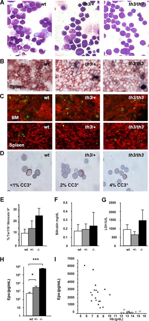 Figure 1. In β-thalassemic mice, there is a decreased number of differentiated cells, a small increase of apoptotic and hemolytic markers, and elevated production of Epo. (A) In cytospins of purified splenic erythroid cells, distinctive types of cells can be seen representing different stages of maturation. More mature cells are characterized by a smaller size, decreased cytoplasmic basophilia, and an increase in nuclear pyknosis. (May-Grünwald Giemsa stain; magnification, 400×.) These observations were corroborated by FACS analyses (Figures S1,S2). Apoptosis was investigated (B) by CC3 assay on spleen sections; (C) by TUNEL assay on BM and spleen sections; (D) by CC3 assay on purified erythroid cells; and (E) by annexin-V assay on fresh spleen and BM cells (data not shown; n ≥ 3 per genotype). For panels A through D, images were captured on a Nikon Eclipse E800 microscope (Melville, NY), with a Retiga Exi camera (Qimaging, Burnaby, BC) and a Plan Fluor 40×/0.75 numeric aperture objective, then acquired using the IPLab 3.65a software (Scanalytics, Fairfax, VA). Brightness/contrast and color balance were adjusted using Adobe Photoshop 7.0.1 (Adobe Systems, San Jose, CA). The levels of hemolytic markers (F) bilirubin and (G) LDH were also investigated (n ≥ 6 per genotype). In panels E-G, th3/+ and th3/th3 mice are indicated as +/− and −/−, respectively. A nonparametric t test was used for statistical analysis. Increased Epo levels inversely correlate with those of hemoglobin in thalassemic mice. Measurements were made of (H) Epo levels in mice 2 months after BMT and (I) Epo and Hb levels in mice up to 1 year of age. In panel H, a nonparametric t test was used for statistical analysis; n ≥ 3 per genotype; P = .037 (*) and P = .001 (***), respectively, for th3/+ and th3/th3 mice compared with wt animals. In this panel th3/+ and th3/th3 mice are indicated, respectively, as +/− and −/−. In panel I, increased Epo levels inversely correlate with Hb in thalassemic mice. Epo levels were measured in random mice up to 1 year of age or 1 year after BMT in wt (□, n = 17) and th3/+ (▲, n = 18) mice. Pearson r test was used to determine the degree of linear association or the correlation coefficient between the Hb and Epo levels (wt, nonsignificant, P = .087; th3/+, P = .027). Error bars represent SD.