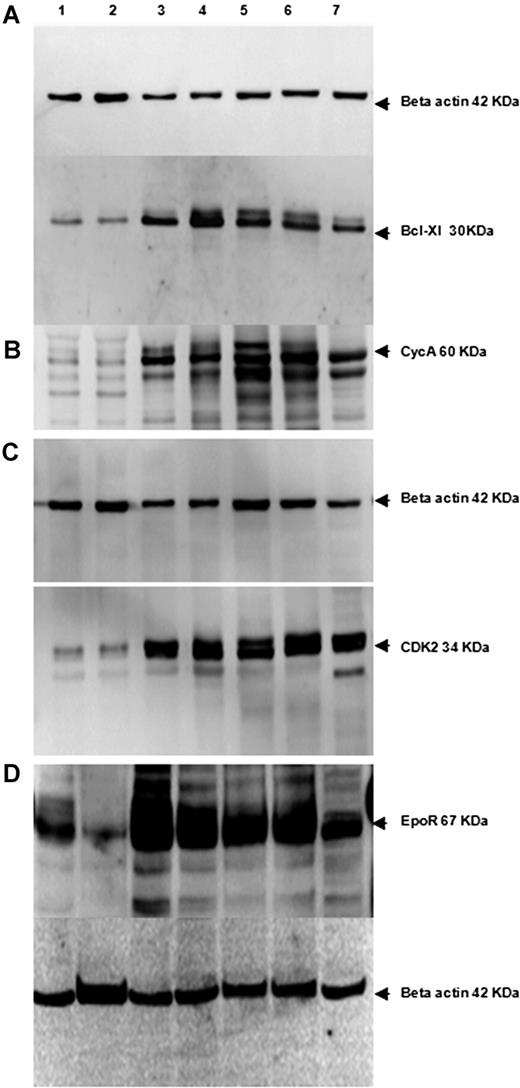 Figure 2. Increased amount of antiapoptotic and cell cycle–related proteins in purified wt and thalassemic erythroid cells. Representative Western blots performed on cells from wt (lanes 1,2), th3/+ (lanes 3,4), and th3/th3 (lanes 5,6) mice, and control cell lines (lane 7) probed with (A) Bcl-XL (control: NIH-3T3 cells), (B) CycA (control: Mel cells); (C) Cdk2 (control: Mel cells); and (D) EpoR (control: K562 cells). The upper band in panel A is described as the deamidated form of the protein. Bcl-XL deamidation has been shown to produce a complete loss of the antiapoptotic function of Bcl-XL.48 Similar ratios of the 2 bands are present in both normal and thalassemic mice. The membrane used for Bcl-XL was reprobed with CycA antibody. Specific antibodies against the phosphorylated and nonphosphorylated forms of the protein were used sequentially. In all cases, the same membranes were reprobed against β-actin as a loading control.