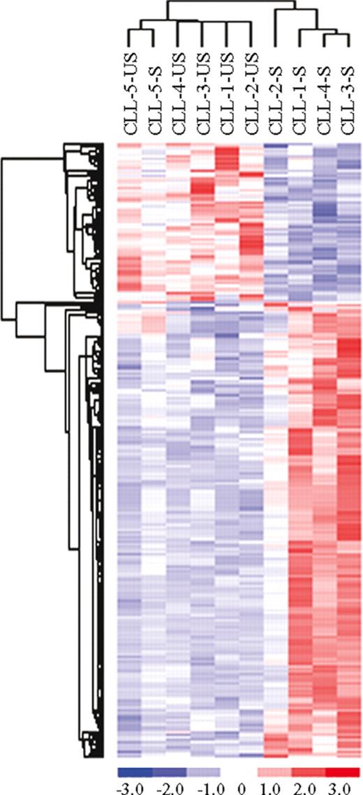 Figure 2. Comparison between unstimulated (US) and stimulated (S) samples in CLL unmutated (UM) patients. Identification of 197 genes differentially expressed between unstimulated (US) and stimulated (S) samples in CLL unmutated (UM) patients.