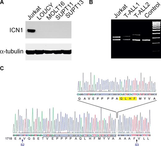Figure 1. Identification of internal tandem duplications in the extracellular juxtamembrane domain of NOTCH1 in T-ALL. (A) Western blot analysis of T-ALL cell lines lacking HD and PEST domain mutations in NOTCH1 demonstrating high levels of activated NOTCH1 in the Jurkat cell line. ICN1 levels were detected with the NOTCH1 Val1744 antibody. Tubulin is shown as loading control. (B) Sequence analysis of the NOTCH1 transcripts showing the mutation identified in the Jurkat cell line. The wild-type NOTCH1 transcript sequence is shown at the bottom and inserted sequences on top. S2 and S3 indicate the sites for ADAM metalloprotease and γ-secretase cleavage, respectively. Duplicated nucleotides are shown in italics and underlined in the wild-type sequence. The common 4 amino acids (QLHF) present in all JME mutants identified in this series are highlighted in yellow. (C) PCR amplification of exon 28 of NOTCH1 and adjacent intronic sequences. Three samples corresponding to Jurkat cells and 2 independent primary T-ALL cases show bands of increased size compared with the control genomic DNA indicating the presence of insertions in the extracellular juxtamembrane domain of NOTCH1.