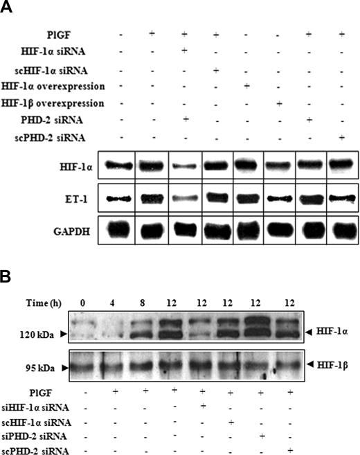 Figure 2. The role of HIF-1α in PlGF-mediated ET-1 mRNA expression. HPMVECs were transfected with indicated plasmids followed by PlGF treatment for 6 hours. (A) RPA. (B) Western blot analysis of nuclear extracts (20 μg) using antibodies to HIF-1α and HIF-1β. Data are representative of 3 different experiments. Where indicated, the vertical lines show the repositioned gel lanes.