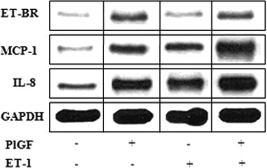 Figure 7. PlGF and ET-1 augment cytochemokine mRNA expression. THP-1 (106 cells/mL) were either treated with PlGF for 24 hours (250 ng/mL) or ET-1 (250 nmol/L) for 30 minutes. For priming, THP-1 cells were first treated with PlGF for 24 hours, washed with PBS and then treated with ET-1 for 30 minutes. Total mRNA was isolated and RPA was performed as described under “RNase protection assay.” The data are representative of 3 independent experiments. Where indicated, the vertical lines show the repositioned gel lanes.