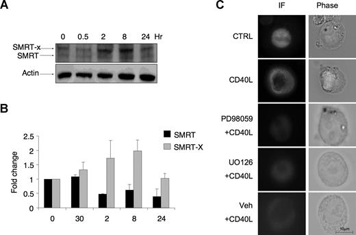 Figure 3. CD40L triggers posttranslation modification of SMRT and its translocation to the cytoplasm. (A) Western blots were performed using SMRT antibody in Ramos cells exposed to CD40L during the indicated time points. Actin Western blots were performed as a loading control. As previously reported, SMRT is represented by 2 bands, a faster migrating product (SMRT) and a slower band (SMRT-X) indicative of a posttranslational modification. (B) The densitometry of 3 independent SMRT Western blot replicates. The signal of each SMRT Western blot was first normalized by actin levels and then expressed as fold change relative to untreated cells. ■ represents the faster migrating band; , the slower migrating posttranslationally modified form of SMRT. Error bars represent SEM. (C) Ramos cells were transfected with a GFP-SMRT-expressing plasmid and then exposed to CD40L for 2 hours. Immunofluorescence and phase contrast microscopy were performed to determine the cellular localization of transfected SMRT. Rows 3 to 5 show experiments in which transfected Ramos cells were pretreated with the MEK kinase inhibitors PD98059 and UO126 or vehicle, followed by exposure to CD40L.