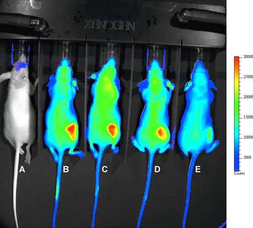Figure 4. In vivo imaging of rituximab's impact on CD20 and CD45 targeting. Mice with established B-NHL (Granta) xenografts placed in the right flank were pretreated with either 400 μg rituximab or 400 μg 1D8 (control) followed by either 200 μg fluoresceinated tositumomab or fluoresceinated BC8 and imaged after 24 hours. (A) Untreated control. (B) 1D8 plus BC8. (C) Rituximab plus BC8. (D) 1D8 plus tositumomab. (E) Rituximab plus tositumomab.