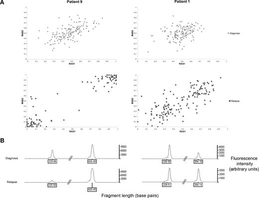 Figure 2. Comparison between patients who have acquired UPD 13q at relapse in the whole leukemic clone (patient 9) or as a subclone (patient 1). (A) Change in relative allele signal (RAS) values between diagnosis and relapse, for SNPs heterozygous at diagnosis in the region of LOH on chromosome 13 for patients 1 and 9. The same SNPs that are heterozygous at diagnosis shift RAS values at relapse, consistent with LOH. (B) Electropherogram showing PCR fragment quantitation of FLT3 wild type, at 329 base pairs, and the larger ITD fragment in patients 1 and 9.