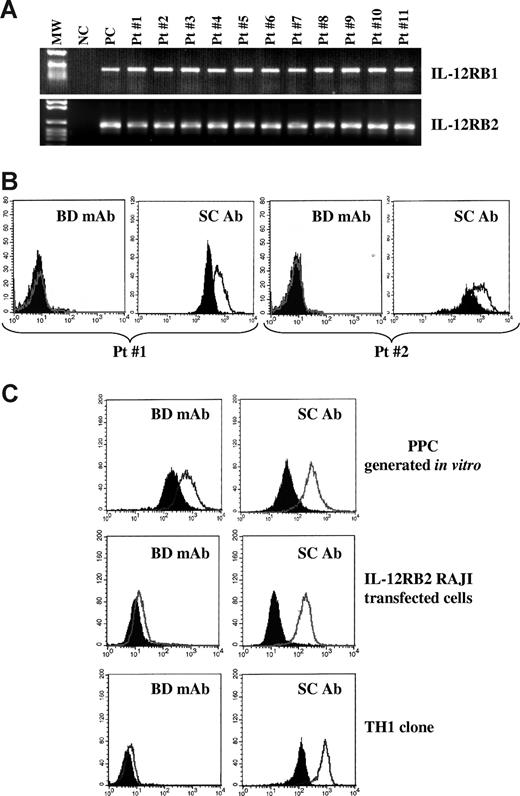 Figure 2. Expression of IL-12Rβ2 in primary CD138+ MM cells. (A) IL-12RB1 and B2 expression in primary CD138+ MM cells, as assessed by RT-PCR. MW indicates molecular weight; NC, negative control (water in the place of cDNA); PC, positive control (total tonsil B cells); 11 MM cases (patients 1-11) are shown. (B) IL-12Rβ2 surface expression in primary CD138+ MM cells (patients 1 and 2), as assessed by flow cytometry using the mAb from BD Biosciences (BD mAb) or the Santa Cruz antibody (SC Ab). Open profile represents IL-12Rβ2 staining; dark profile, isotype-matched Ab staining. (C) Flow cytometric analysis of IL-12Rβ2 expression in PPCs generated in vitro (top panels), IL-12RB2-transfected Raji Burkitt lymphoma cells (middle panels), and a normal T helper 1 clone using the BD Bioscences mAb (left panels) and the Santa Cruz antibody (right panels). Open profile represents IL-12Rβ2 staining; dark profile, isotype-matched antibody staining.