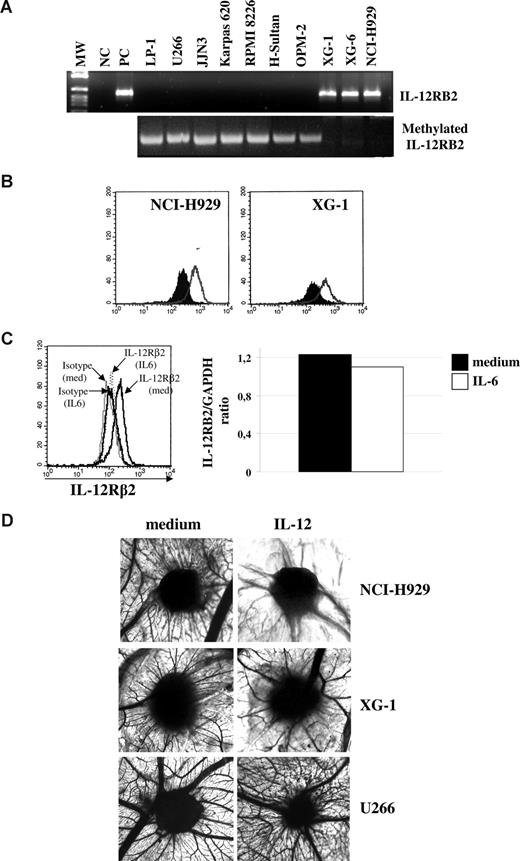 Figure 5. Expression and function of IL-12R in MM cells. (A) Top panel: IL-12RB2 expression in MM cell lines as assessed by RT-PCR. MW indicates molecular weight; NC, negative control (water in place of cDNA); PC, positive control (total tonsil B cells); different MM cell lines (LP-1, U266, JJN3, Karpas 620, RPMI 8226, H-Sultan, OPM-2, XG-1, XG-6, and HCI-H929) are shown. Bottom panel: Methylation specific PCR analysis of MM cell lines. MM cell lines that do not express the IL-12RB2 mRNA (LP-1, U266, Karpas 620, RPMI8226, H-Sultan, and OPM-2) show the amplification band corresponding to the methylated target sequence, whereas MM cell lines that express IL-12RB2 mRNA (XG-1, XG-6, and NCI-H929) failed to amplify the methylated sequence. (B) IL-12RB2 expression in NCI-H929 and XG-1 MM cell lines, as assessed by flow cytometry using the anti IL-12Rβ2 antibody from Santa Cruz. Open profile represents IL-12Rβ2 staining; dark profile, isotype-matched antibody staining. (C) Left panel: IL-12Rβ2 protein expression in NCI-H929 cells cultured with medium alone or with hrIL-6 for 48 hours, as assessed by flow cytometry using the Santa Cruz antibody. Right panel: Quantitative analysis of IL-12RB2 versus GAPDH transcript in the same NCI-H929 cell suspensions analyzed in the left panel, cultured with (□) or without (■) IL-6. (D) Angiogenic activity of supernatants from NCI-H929 (top panels), XG-1 (middle panels), and U266 (bottom panels) cells cultured in the presence or absence of hrIL-12, as assessed by CAM assay.