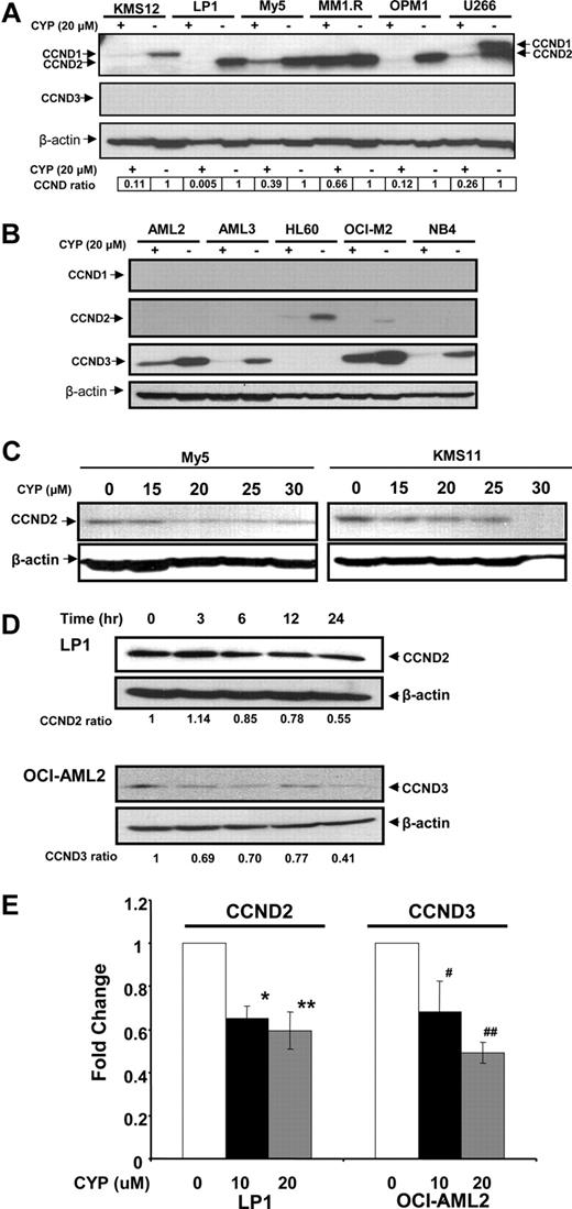 Figure 1. Cyproheptadine reduces expression of cyclin D2 in multiple myeloma lines. (A) KMS12, LP-1, OCI-MY5, MM1.R, OPM1, and U266 multiple myeloma cells and (B) OCI-AML2, OCI-AML3, HL60, OCI-M2, and NB4 leukemia cells (106) were treated with 20 μM of cyproheptadine (CYP). Twenty-four hours after incubation, cell lysates were prepared, normalized for total protein, and analyzed by SDS-PAGE/immunoblotting using antibodies specific for cyclin D1, D2, D3, and anti–β-actin. CCND ratio represents (density of the D-cyclin)/(density of β-actin) relative to control cells. (C) OCI-MY5 and KMS11 myeloma cells (106) were treated with increasing concentrations of cyproheptadine. Twenty-four hours after incubation, cell lysates were prepared, normalized for total protein, and analyzed by SDS-PAGE/immunoblotting using antibodies specific for cyclin D2 and anti–β-actin. (D) LP1 myeloma and OCI-AML2 leukemia cells (106) were treated with 15 μM of cyproheptadine. At increasing times after incubation, cell lysates were prepared, normalized for total protein, and analyzed by SDS-PAGE/immunoblotting using antibodies specific for cyclin D2 and cyclin D3. CCND ratio represents (density of the D-cyclin)/(density of β-actin) relative to control cells. (E) LP1 myeloma and OCI-AML2 leukemia cells (106) were treated with 10 and 20 μM of cyproheptadine. Twenty-four hours after incubation, total cellular RNA was isolated. Cyclin D2 (CCND2) and Cyclin D3 (CCND3) mRNA expression were measured relative to 18S RNA by real-time RT-PCR. Data represent the mean plus or minus SEM fold change of CCND2/18S or CCND3/18S expression relative to untreated controls (ΔΔCT normalization) from 4 independent experiments. *P = .017, **P = .004, #P = .015, ##P = .006, all by Student t test.