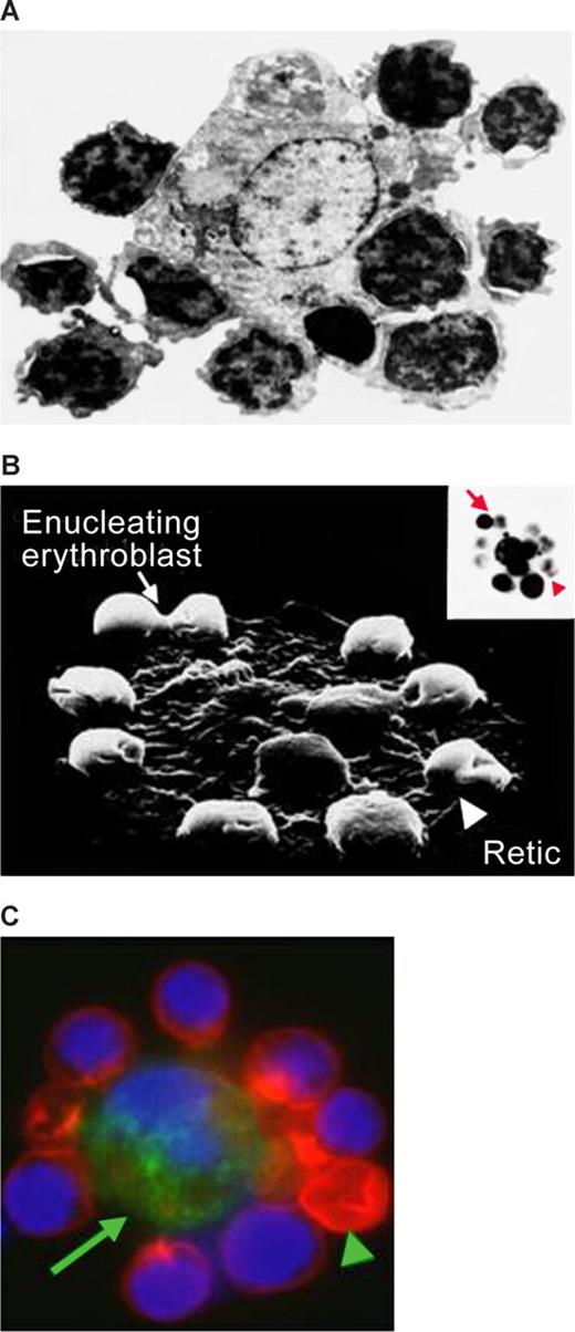 Figure 1. Micrographs of erythroblastic islands. (A) Transmission electron micrograph of an erythroblastic island isolated from rat bone marrow. Note the extensive cell-cell contact. (B) Scanning electron micrograph of an isolated erythroblastic island. The inset shows an optical microscopic image of the same structure. Note the presence of an enucleating erythroblast () and a multilobulated reticulocyte (). (C) Confocal immunofluorescence image of an island reconstituted from freshly harvested mouse bone marrow cells stained with erythroid-specific marker (red), macrophage marker (green) and DNA probe (blue). Central macrophage is indicated by an arrow and a multilobulated reticulocyte by an arrowhead. (Panels A and B are courtesy of Michel Prenant of France, and panel C is reprinted from Lee et al24 with permission from the American Society of Hematology.) Illustration by Paulette Dennis.
