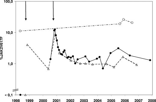 Figure 1. Evolution over time of the JAK2V617F mutational burden. The percentage JAK2V617F value represents the ratio of JAK2V617F mutated DNA to all JAK2 DNA present in a sample as measured by quantitative polymerase chain reaction. The 2 arrows above the graph represent the first and second allogeneic transplantations. Donor samples (○) are connected with a dashed-pointed line, recipient peripheral blood samples (■) are connected with a full line, and recipient bone marrow samples () are connected by a dashed line.
