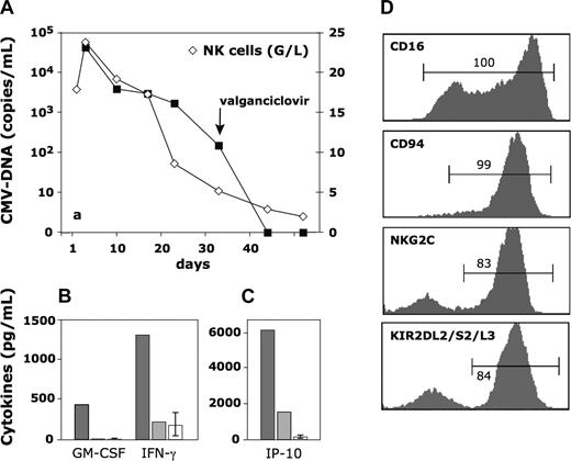 Figure 1. Kinetics of NK-cell expansion and cytokine serum-levels in relation to viral load, and phenotype of the expanded NK cells. (A) Number of CMV-DNA copies (■-■) and number of NK cells (◇-◇). The number of NK in the last sample (day 50) is at the upper limit of that in normal age-matched controls. → indicates the first day of oral valganciclovir given to maintain CMV suppression. (B,C) Serum cytokine-levels during viremia (, day 9 in panel A) and in a late CMV-DNA free sample (, day 43 in panel A). □ depicts the mean value plus or minus SD in 10 healthy controls. (D) FACS analysis of the respective marker with gates on CD3-CD56+ lymphocytes.