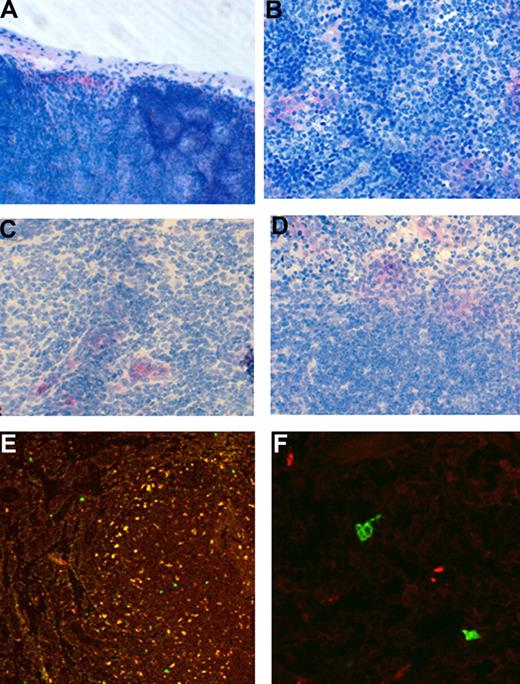 Figure 4. Localization of adoptively transferred monocytes in lymph node and spleen differs with antibody treatment. Freshly isolated EGFP bone marrow–derived monocytes (8 × 106) were injected intravenously into control mice or mice immunized 21 to 24 days previously with peptide to induce EAU. Mice were then treated with mAb for up to 3 days. Groups of mice were killed at 30 minutes and 24 hours after a single treatment or after 3 treatments. Tissue samples were then snap frozen, cryosectioned, and immunostained using the APPAP technique (A-D) for the presence of EGFP+ cells using a specific antibody, or examined by confocal microscopy (E,F). Original magnification ×400 (A-D); ×200 (E); ×640 (F).