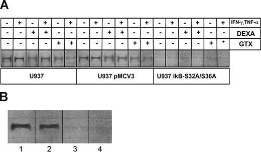 Figure 7. Electrophoretic mobility shift assay of NF-κB binding activity in U937 cells and EBV-transformed B-cell lines. (A) In wild-type (left panels) and pMCV3-transfected (middle panels) U937 cells, induction by IFN-γ and TNF-α caused an increase in binding activity of p50/Rel to an oligonucleotide representing the distant upstream NF-κB site in the CYBB gene. Binding activity was inhibited by dexamethasone (DEXA) or gliotoxin (GTX). No NF-κB binding activity was observed in U937 transfected with the super-inhibitor IκB S32A/S36A, regardless of pharmacological treatment. Representative image, n = 6. (B) Cell lines were derived as follows: lane 1, healthy donor; lane 2, a patient with CGD; and lanes 3 and 4, 2 patients with EDA-ID. Normal B-cell nuclei showed considerable binding activity of p50/Rel to an oligonucleotide representing the distant upstream NF-κB site in the CYBB gene, as also observed in the B-cell line from a patient with X-linked CGD. Reduced formation of the NF-κB complex was observed in B-cell lines derived from the patients with EDA-ID. Representative image, n = 4.