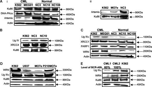 Figure 1. BCR-ABL–positive CML cell lines show down-regulation of major NHEJ proteins, Artemis, and DNA ligase IV, and up-regulation of alternative NHEJ proteins, DNA ligase IIIα, and WRN. (Ai) Western blotting using nuclear extracts from 2 BCR-ABL–positive CML cell lines (K562 and MEG01), and 3 EBV-transformed B-cell lines, established from healthy individuals (NC3, NC10, and NC108), and (Aii) 1 BCR-ABL–negative CML cell line (MO7e). Artemis shows down-regulation (4- to 7-fold) in BCR-ABL–positive CML cell lines. Either actin or Ku86 was used as loading control. (B) Western blotting using nuclear extracts from K562 shows 2- to 3-fold decrease in DNA ligase IV expression, compared with EBV-transformed B-cell lines (NC3 and NC10). Ku86 was used as loading control. (C) Western blotting using nuclear extracts from 2 BCR-ABL–positive CML cell lines (K562 and MEG01) and 3-EBV transformed B-cell lines (NC3, NC10, and NC108). CML cell lines show up-regulation of DNA ligase IIIα (3- to 6-fold). PARP1 expression is unchanged. Werner syndrome protein, WRN, shows up-regulation (4- to 7-fold) in CML cell lines. Actin was used as loading control. (D) BCR-ABL–negative MO7e shows down-regulation of DNA ligase IIIα and WRN compared with BCR-ABL–positive P210MO7e and K562. Western blotting using nuclear extracts from 2 BCR-ABL–positive cell lines (K562 and P210MO7e) and BCR-ABL–negative cell lines (U937 and MO7e). Actin was used as loading control. (E) Primary CML bone marrow mononuclear cells show down-regulation of DNA ligase IIIα and WRN. Western blotting using nuclear extracts from CML cell line (K562) and 2 CML patients (CML1, CML2) at diagnosis. Patient CML1 shows decreased DNA ligase IIIα and WRN expression with decreased levels of BCR-ABL positivity by FISH. Patient CML2 shows increased expression of DNA ligase IIIα and WRN, with 100% BCR-ABL positivity. BCR-ABL–positive CML cell line K562 was used as a positive control. Ku86 and actin were used as loading controls.