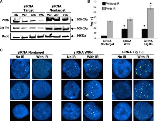 Figure 4. siRNA down-regulation of WRN and DNA ligase IIIα in CML cell line. (A) Nuclear extracts were prepared at 4 different time points (0h, 24h, 48h, and 72h) after siRNA treatment of cells. Western blotting was performed using WRN antibody (90% knockdown; top panel) and DNA ligase IIIα antibody (75% knockdown; middle panel). siRNA using nontarget oligonucleotides were used as controls. Ku86 was used as loading control (bottom panel). (B) Bar graph showing the percentage of K562 cells with more than 5 γH2AX foci examined in siRNA nontarget, siRNA knockdown of WRN and DNA ligase IIIα cells with or without irradiation (IR; 2.5 Gy). Black bars indicate no IR and gray bars are with IR treatment. Two hundred nuclei were examined from each of 3 different experiments. Values significantly different are marked with an asterisk (P < .01 by Student t test). Error bars reflect the standard error of the mean. (C) Images of 3 different cells showing γH2AX foci (FITC, green signal) in K562 following siRNA nontarget (left panels), siRNA down-regulation of WRN (middle panels), and DNA ligase IIIα (right panels), with and without irradiation.