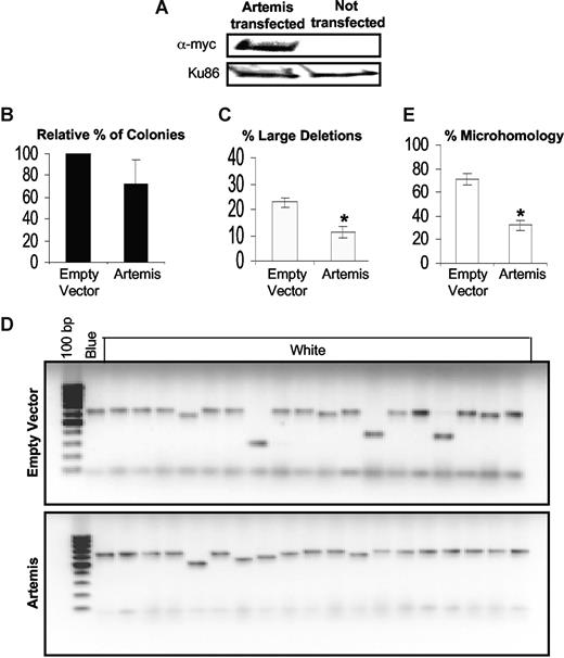 Figure 7. Artemis overexpression in K562 leads to a decrease in large deletions. (A) Western blotting in K562 cells transfected with the myc-tagged Artemis cDNA construct (pcDNA huASC1D) showing Artemis overexpression. Ku86 was used as loading control. An in vivo LacZα plasmid reactivation assay was used to measure end joining in Artemis overexpressed cells, compared with empty vector–transfected controls. (B) Relative percentage of colonies, indicating the efficiency of end joining. (C) Graph of percentage of large deletions, defined as more than 20 bp. (D) Agarose gel showing PCR products of repaired colonies in empty vector controls and Artemis overexpressed K562 cells. (E) The percentage of plasmids repaired using DNA sequence microhomologies of 1 to 6 bp. Fifteen plasmids were sequenced. Values significantly different are marked with an asterisk (Student t test; P < .001 for panels C and E). Error bars reflect the standard error of the mean.